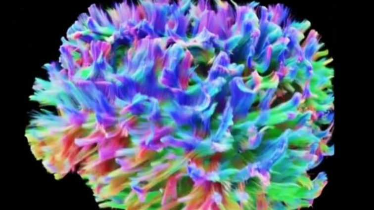 Ученые показали детально изображение мозга человека